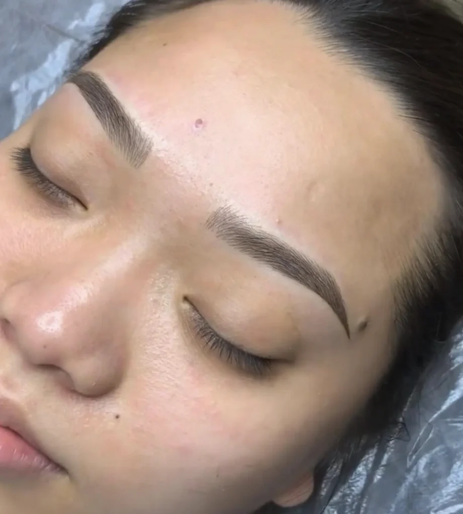 Cosmetic eyebrow tattooing